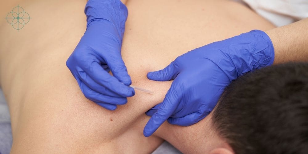 Elemental Dry Needling